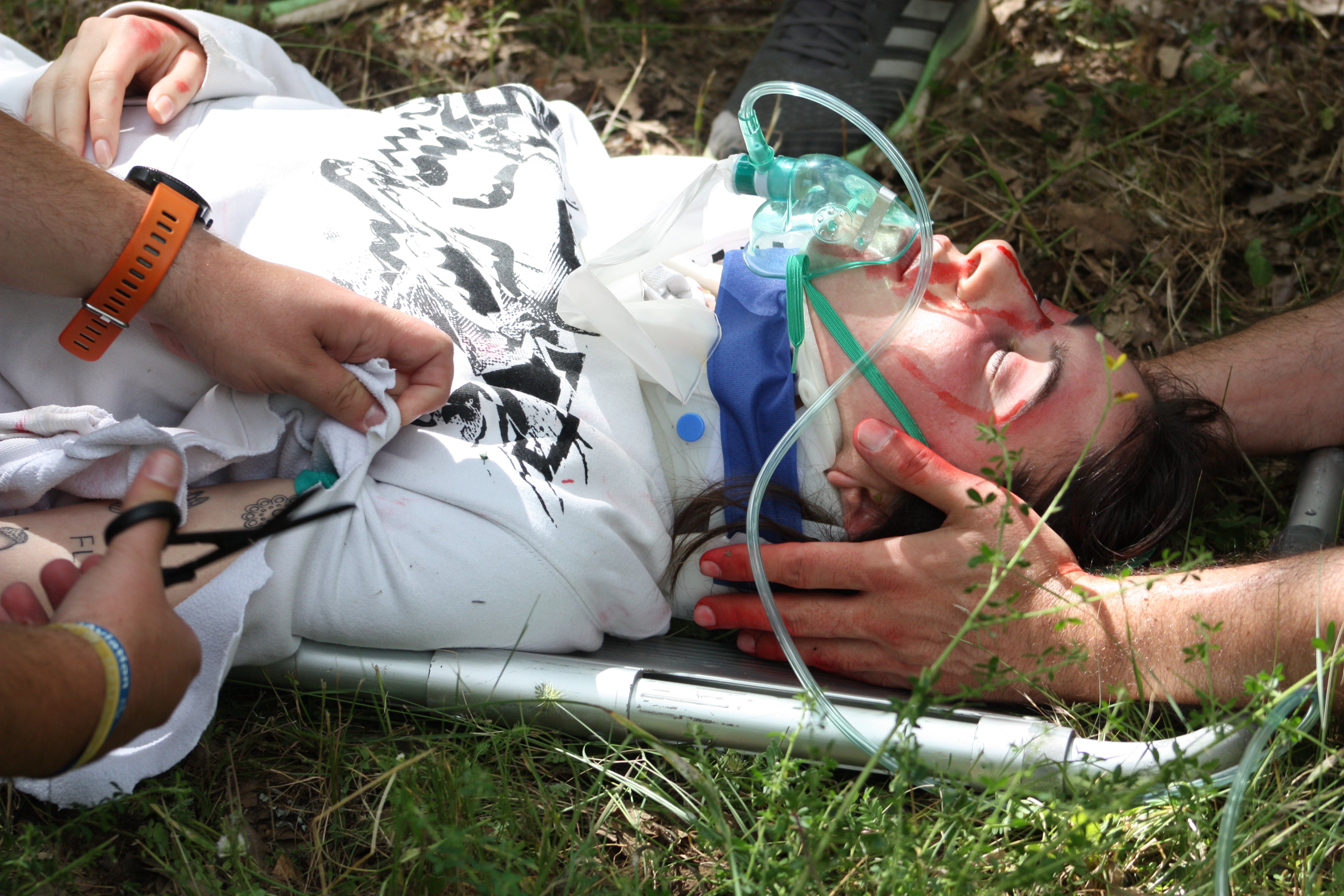 Oxigenación para TES en SVB